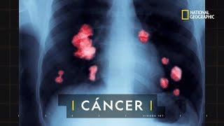 ¿Qué es el cáncer y cómo comienza? | 101 Videos