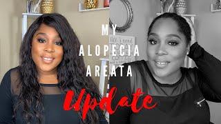 My Alopecia Areata UPDATE | Reveal