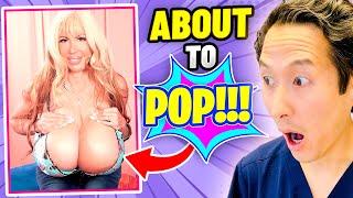 She Has the LARGEST BREASTS Ever!! EXTREME Bodies EXPLAINED!