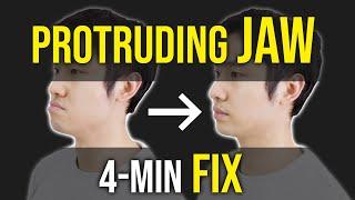 Protruding Jaw / Underbite Fix ｜Facial Asymmetry Correction｜Corrective Exercises