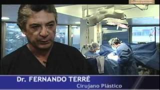 Abdominoplastía en Clínica Terré. Logra un abdomen plano y firme.