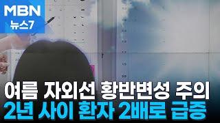 구부러진 글자에 검은 점, 황반변성 의심…여름철 자외선 주의 [MBN 뉴스7]