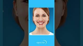 예민한 사춘기 치아교정 #teenth_orthodontics #투명교정장치  #인비절라인 #invisalign #평택인비절라인 #교정하기최적의시기