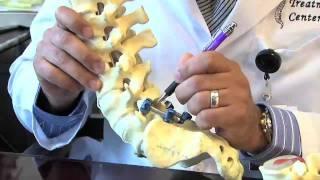 Surgical Procedures - Lumbar Laminectomy & Discectomy