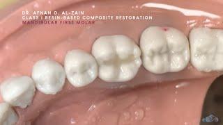 Class I composite restoration (1) – Horizontal incremental technique (#36) - Arabic عربي