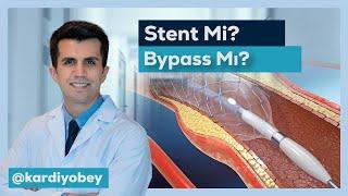 Ana Damar Tıkanıklığında Stent Mi? Bypass Mı?