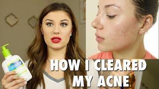 My Skincare Routine | Emily Freybler