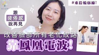 法令紋?木偶紋? 鳳凰電波拯救您的全臉大小問題️【羽田醫美診所．羽田診所．吳佩謙】#燒肉媽媽  #鳳凰電波 #細紋 #法令紋