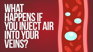 What Happens If You Inject Air Into Your Veins?