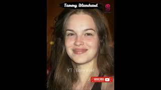 Tammy Blanchard Age Transformation #bollywiki #ytshorts #transformationvideo #journey #celebrity