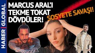 Öldüresiye Dövüldü! Model Şevval Şahin'in Sevgilisi Marcus Aral Saldırıya Uğradı