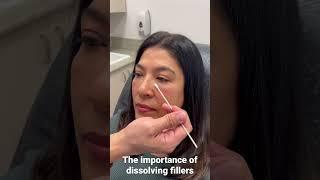 The Important of Dissolving Fillers | Dr.Kwok @ Skin Perfect Rancho #filler #injector