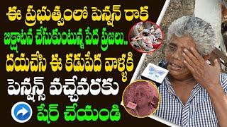 AP Poor People Not Received Pension In Jagan Govt | AP Public Talk on Pension Scheme