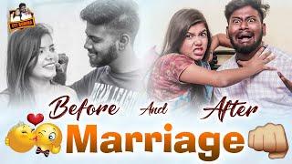 BEFORE AND AFTER MARRIAGE || EYYBOMMA || ARUSHI GOEL || TEJA VIKKY