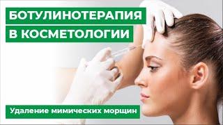 Ботулинотерапия в косметологии. Удаление мимических морщин.