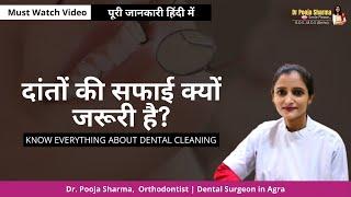 What is Dental Cleaning? Know the advantages and Complete procedure - Dr. Pooja Sharma