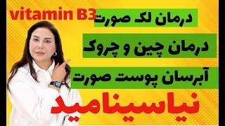 درمان چین و چروک/لک/منافذ صورت تضمینی- جوانسازی پوست صورت با نیاسینامید VITAMIN B3