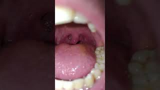 Playing with my saliva | VORE UVULA SALIVA #UVULA #SALIVA #VORE