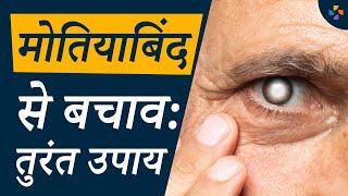 मोतियाबिंद के लक्षण और इलाज | Cataract - Symptoms And Treatment