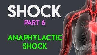 Anaphylactic Shock | Shock (Part 6)