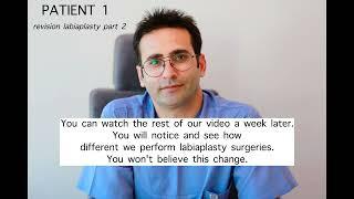 Revision Labiapasty Part 2 | You Should See More Than One Doctor