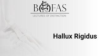 Hallux Rigidus - BOFAS Lectures of Distinction