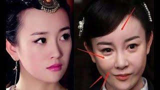 15 Chinese Actors Who RUINED Their Faces With Too Much Plastic Surgery