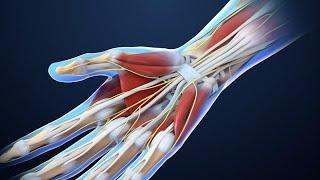 Carpal Tunnel Syndrome | Nucleus Health