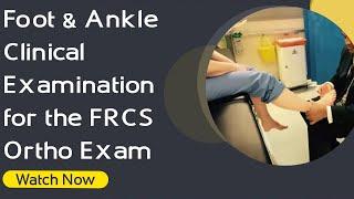 Foot & Ankle Clinical Examination for the FRCS Ortho Exam | Orthopaedic Academy