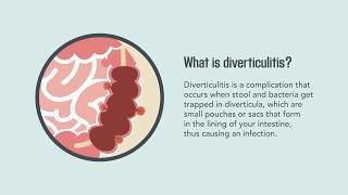 Diverticulitis: Signs, Symptoms, Causes, and Treatment | Merck Manual Consumer Version Quick Facts