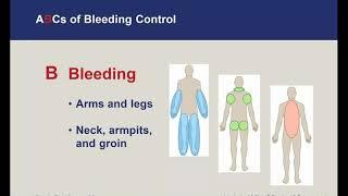 Stop the Bleed