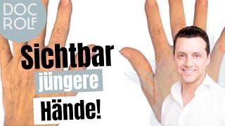 HANDVERJÜNGUNG mit Radiesse: Behandlung + vorher/nachher