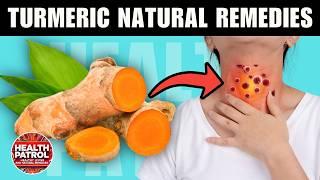 TURMERIC Everyday ~ Benefits ~ Natural Remedy | Health Patrol