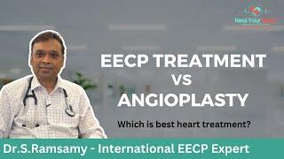 EECP Treatment vs Angioplasty | Which is better heart treatment ?