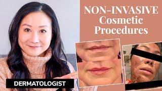 Dermatologist Explains NON INVASIVE Cosmetic Procedures | Botox, Fillers, Peels, Lasers, + MORE