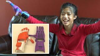 11-Year-Old Gets 3D-Printed Hands After Dad Meets Engineering Student in Uber