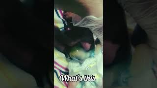 NICU Neonatal Intensive Care Unit | NICU Neonatal Intensive Care Unit - Special Newborn Care Unit