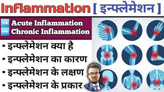 Inflammation | Inflammation and Infection | Inflammation Pathology | Inflammation in Hindi