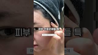 엉니가 알려줄게 피부 좋아지는 법!