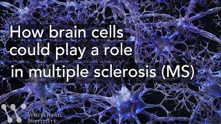 How brain cells could play a role in multiple sclerosis (MS)