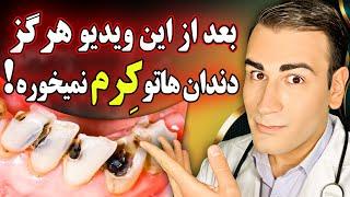 از این به بعد هرگز درگیر پوسیدگی و کرم خوردگی دندان نخواهید شد! | No More Dental Cavities