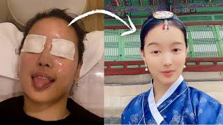 I Got Plastic Surgery in Korea