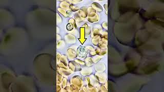 Infection under the microscope!