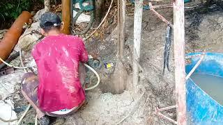 A Simple drilling procedure (cebu city)