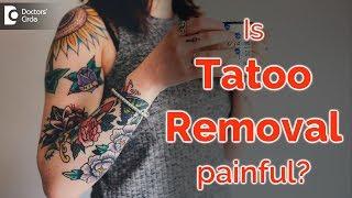 Is it painful to remove tattoo? - Dr. Rasya Dixit