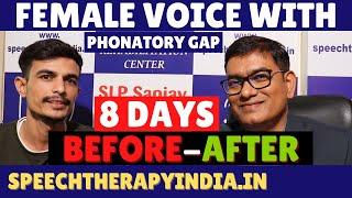 Transforming Female Voice With Phonatory Gap in Just 8 Days | AIIMS Delhi Alumnus #slpsanjaykumar