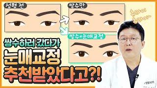 [Eye correction]You went to get double eyelid surgery and got a recommendation for eye correction?