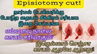 Normal delivery stitches fast recovery tips in tamil. தையல் பத்தின பயமே வேண்டாம்!இதை செய்யுங்க!