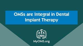 Dental Implants: When to See an OMS