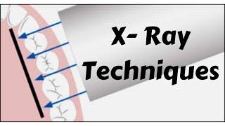 How to take #dental  #xray  or RVG? Tips & Tricks for IOPA Periapical Bitewing Radiograph